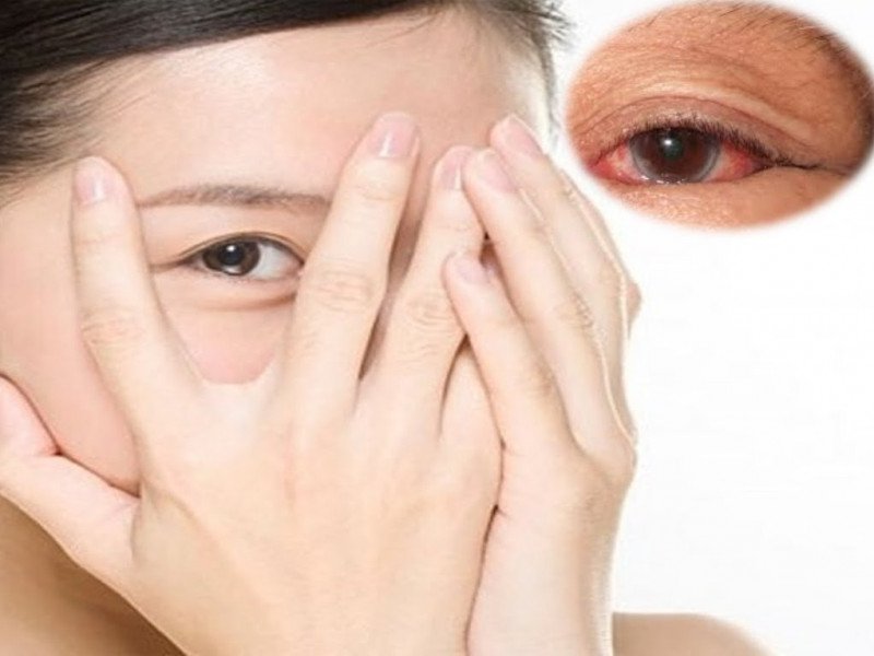 Chăm sóc mắt cẩn thận sau khi phẫu thuật